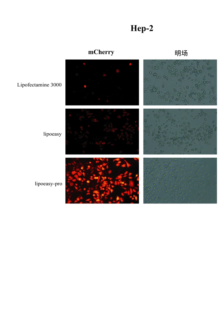 Hep2 transfection